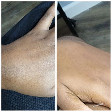 Before and After Geneo Reviving Hand Treatment 