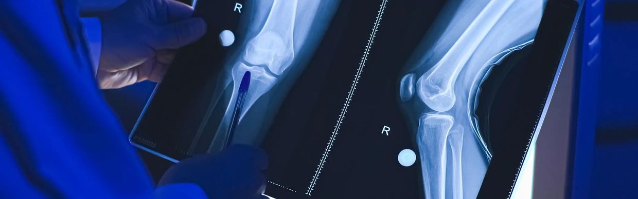 Doctor examining X-ray images of a right knee joint.
