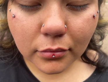 Close-up of a face with multiple fresh piercings and some bleeding.