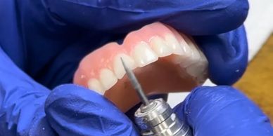 Dentist polishing a dental prosthetic.