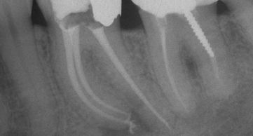 Los Angeles dentists Poria Edalat Saman Sina California Las Vegas dentist Monterey hills dental DDS