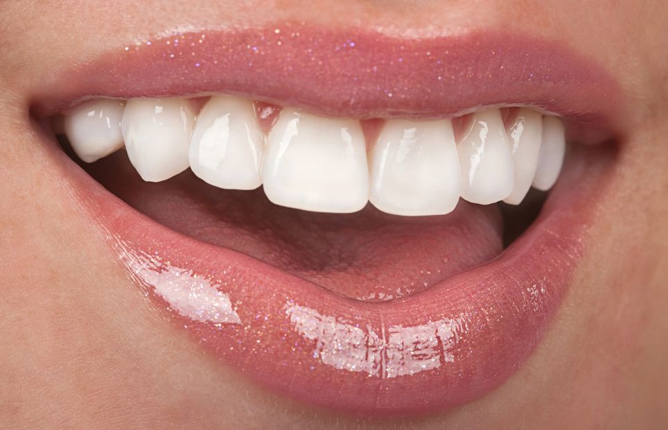 Los Angeles dentists Poria Edalat Saman Sina Las Vegas dentist Monterey hills dental, Zara Edalat