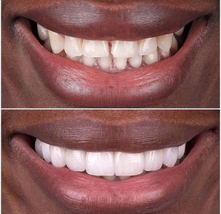 Los Angeles dentists Poria Edalat Saman Sina California Las Vegas dentist Monterey hills dental DDS