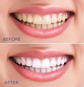 Los Angeles dentists Poria Edalat Saman Sina California Las Vegas dentist Monterey hills dental DDS