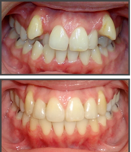 Los Angeles dentists Poria Edalat Saman Sina California Las Vegas dentist Monterey hills dental DDS
