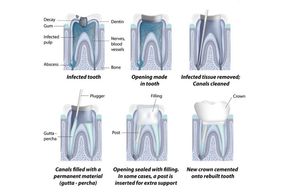 Los Angeles dentists Poria Edalat Saman Sina California Las Vegas dentist Monterey hills dental DDS