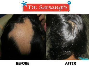 Root causes of hair loss—from hormonal imbalances, nutritional deficiency- consult today