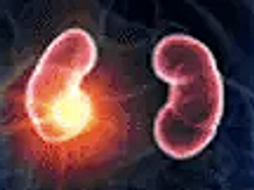 Renal tumors - can be ablated or embolised