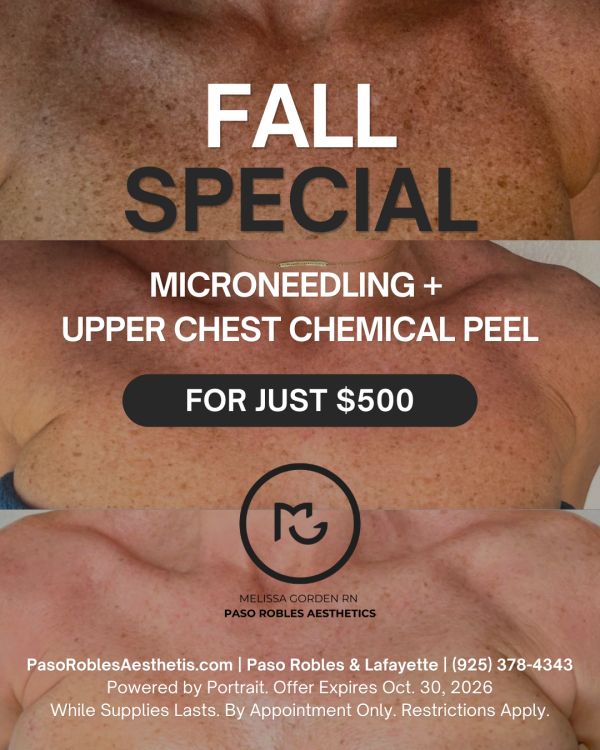 Fall special for microneedling and chemical peel at $500.