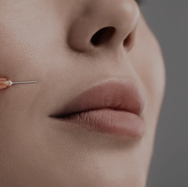 Facial Fillers