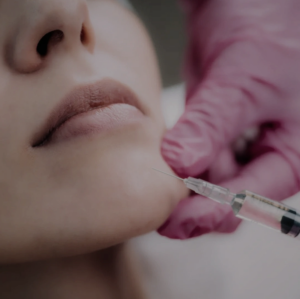 Chin Filler