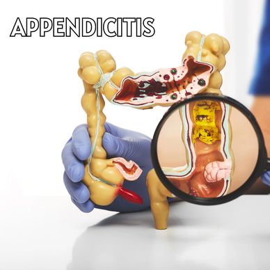 unani treatments for appendicitis
