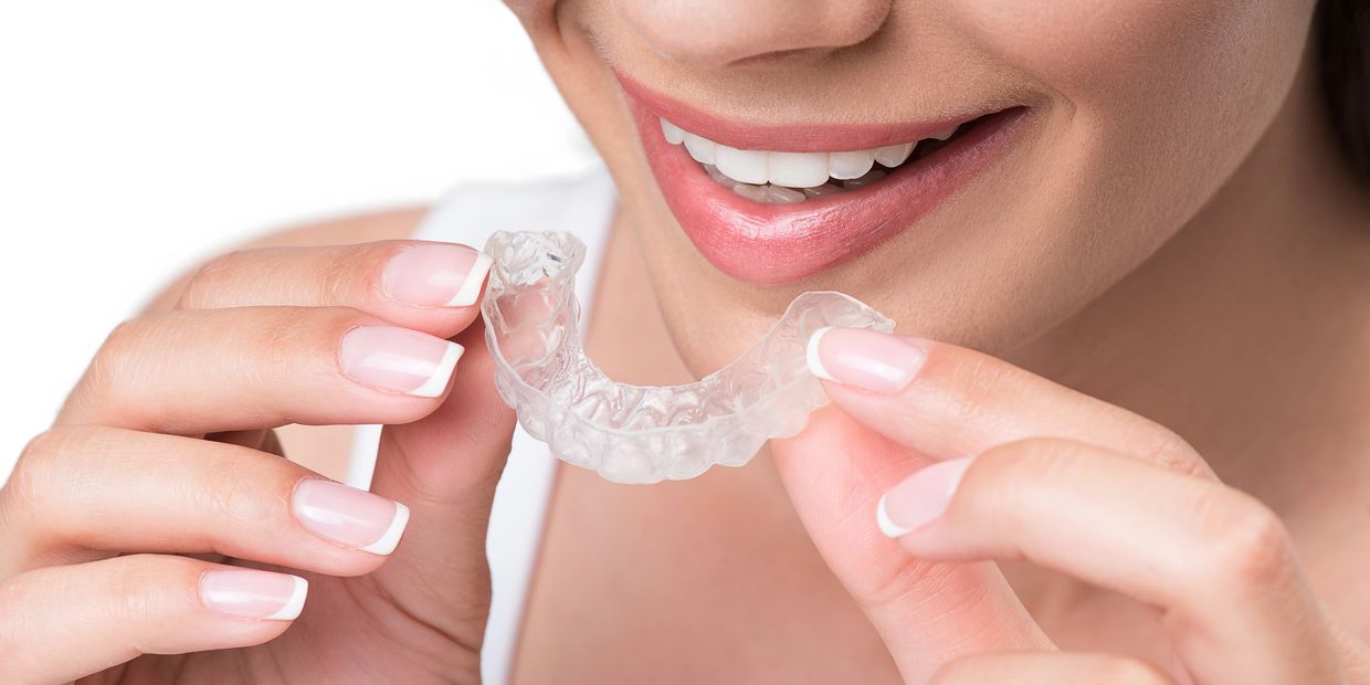 FMR CLEAR ALIGNERS