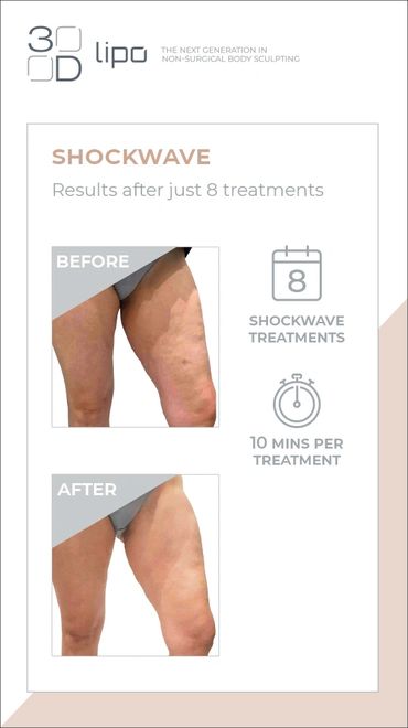 cellulite removal, thigh, body, arms, cellulite reduction, laser hair removal, treatment, cellulite