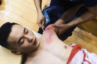 Sports Massage, physiotherapy, therapeutic stretching, shoulder injury