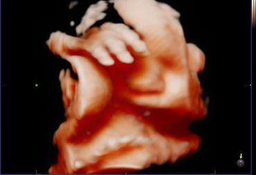 3D 4D fetal ultrasound at 31 weeks Memories In 4D Medina Ohio