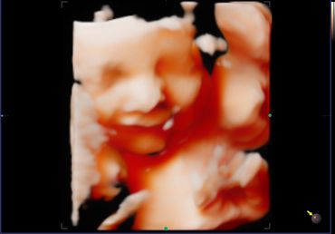 3D 4D fetal ultrasound at 30 weeks Memories In 4D Medina Ohio