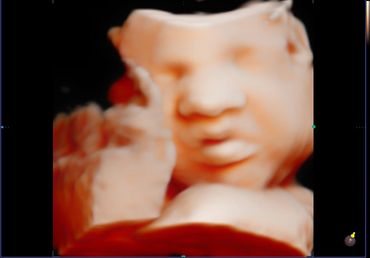 3D 4D fetal ultrasound at 33 weeks Memories In 4D Medina Ohio