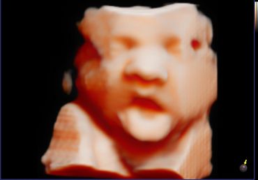 3D 4D fetal ultrasound at 33 weeks Memories In 4D Medina Ohio