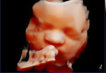 3D 4D fetal ultrasound at 32 weeks Memories In 4D Medina Ohio
