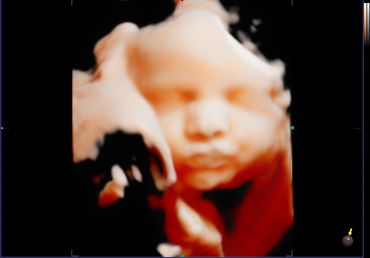 3D 4D fetal ultrasound at 30 weeks Memories In 4D Medina Ohio