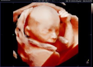 3D 4D fetal ultrasound at 20 weeks Memories In 4D Medina Ohio