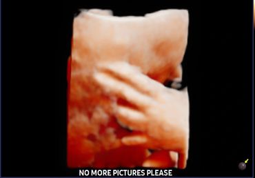 3D 4D fetal ultrasound at 29 weeks Memories In 4D Medina Ohio