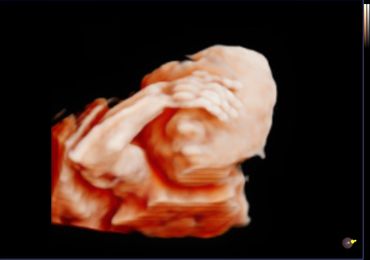 3D 4D fetal ultrasound at 22 weeks Memories In 4D Medina Ohio