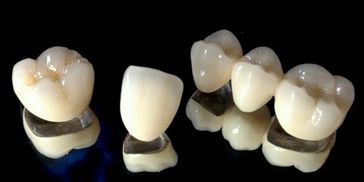 Dental Crown and Bridge of teeth Lucknow