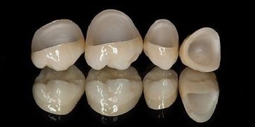 Dental Crown and Bridge of teeth Lucknow