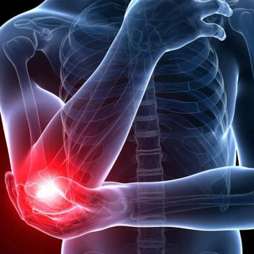 X-ray image showing elbow pain.