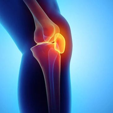 3D rendering of a knee joint highlighting the patella in red.
