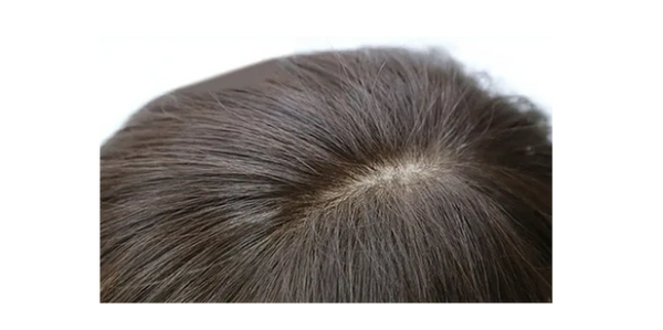 Artificial realistic scalp