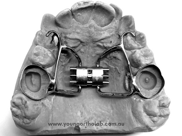 Banded RME with Rest