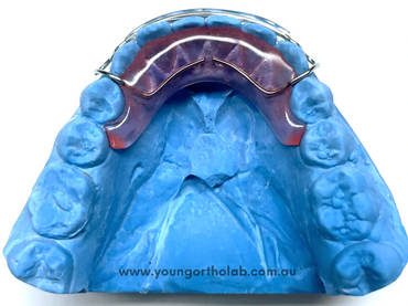 Lower spring Aligner