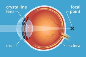 Diagram of eye