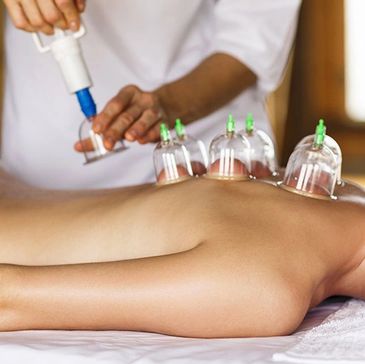 Myofascial Cupping