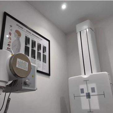 X-rays to show spinal degeneration and cause of pain in lower back. found in Altrincham near me