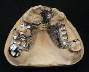 Chrome Cobalt Dentures