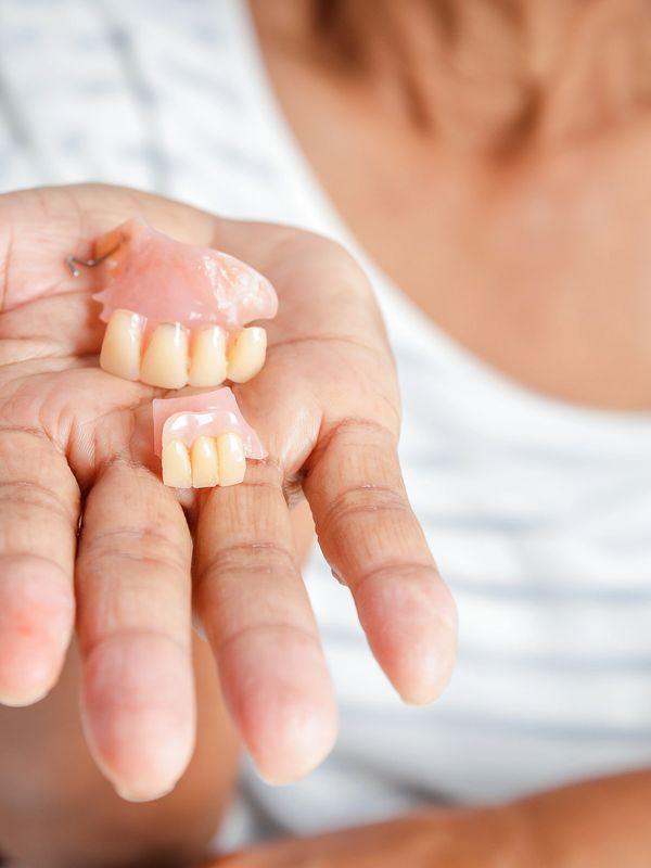Will van Leeuwen Dental Prosthetist Dapto 
Denture Repair or Reline