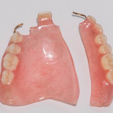 Broken Denture Repairs at Artistic Denture Design