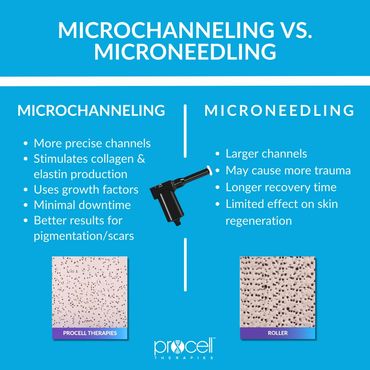 Infographic talking about microchanneling versus microneedling at Pathway Health and Beauty in Owas