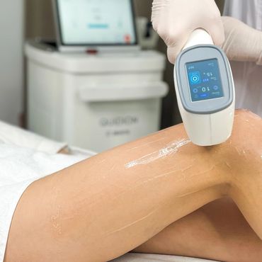 Laser hair removal session on the leg with Zemits Quidion 3W equipment.