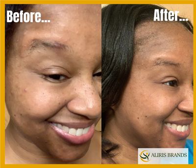 Transformation image of facial before and after Body Wash use.