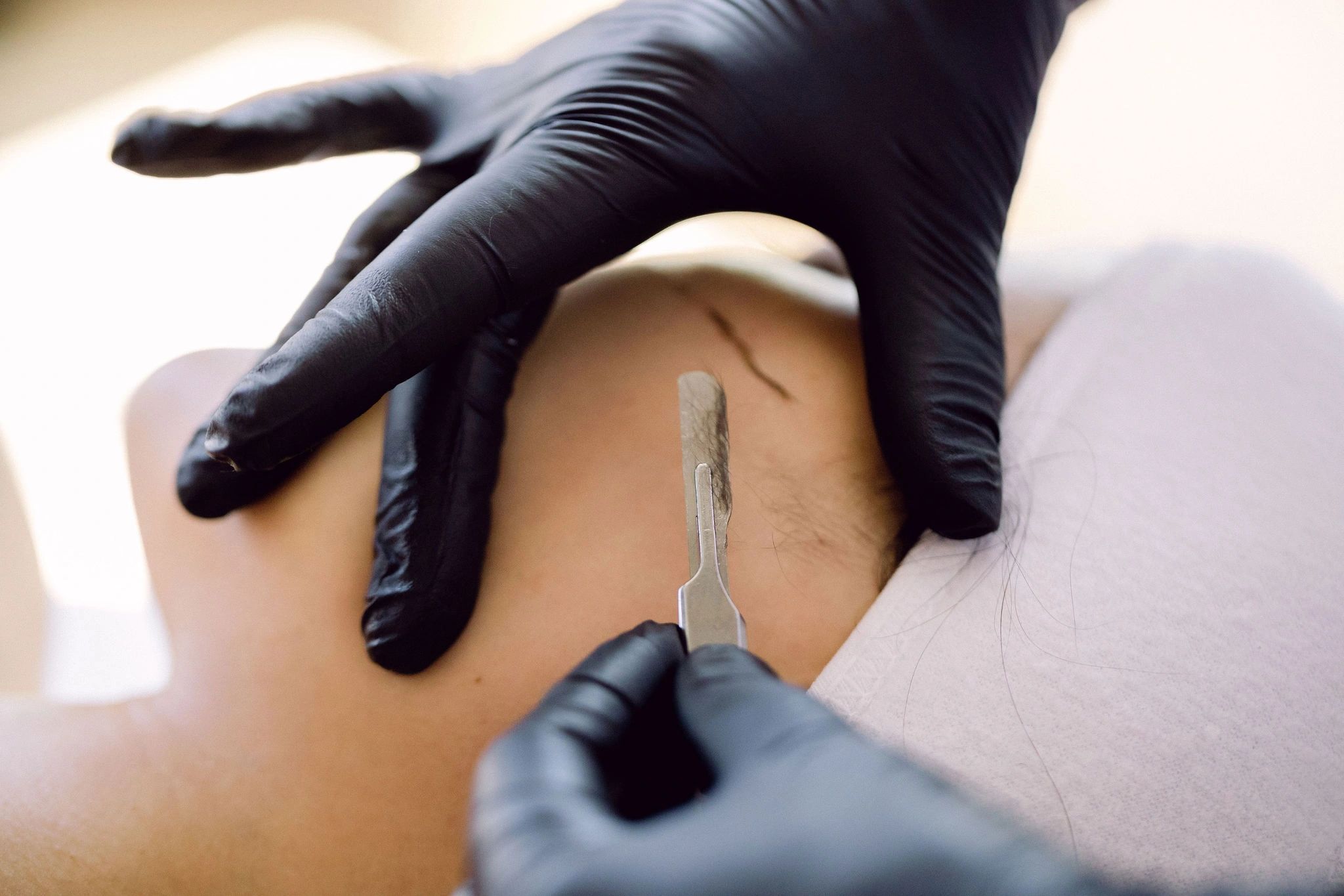 Dermaplaning service in Flagstaff for exf