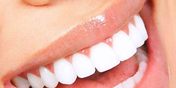 El diseño de sonrisa de alta estética con tecnología CAD/CAM representa la vanguardia en odontología