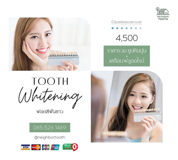 Advertisement for tooth whitening services at 4,500 price with contact details.