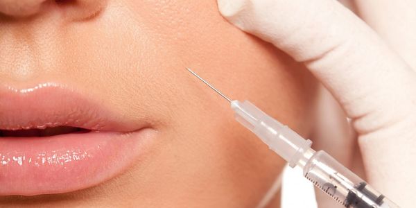 dermal filler injection