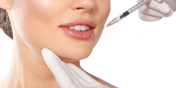 marionette line filler injection