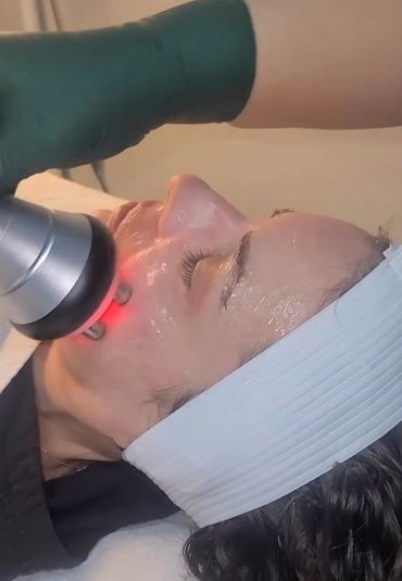 RF (Radio Frequency) Skin Tightening Facial
